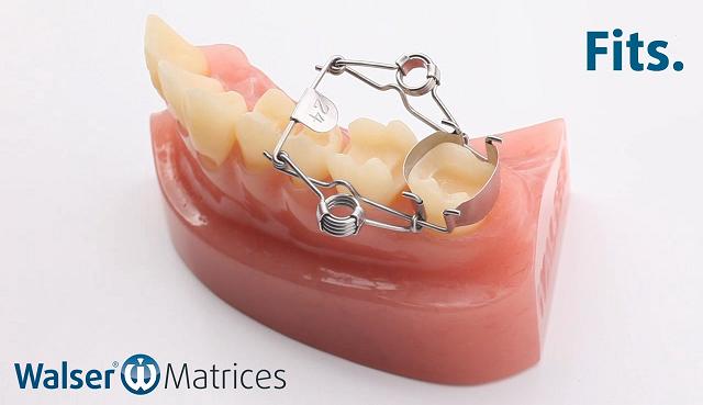 Insert the on-shape tooth matrix, which is automatically applied to the tooth with a hand movement