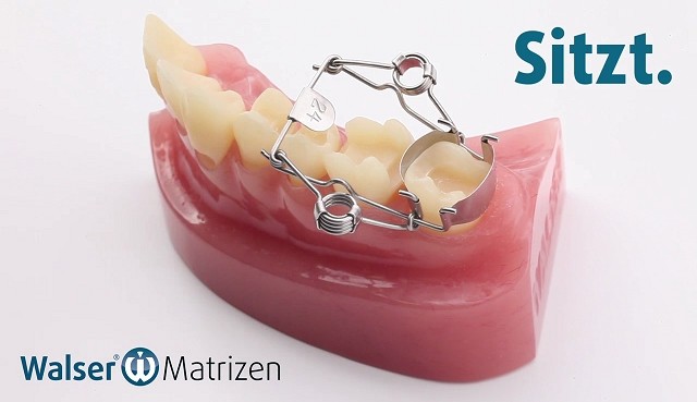 Die Zahn-Matrize spannt sich automatisch um den Zahn Die Walser Zahn-Matrize spannt sich automatisch um den Zahn wie ein Korsett