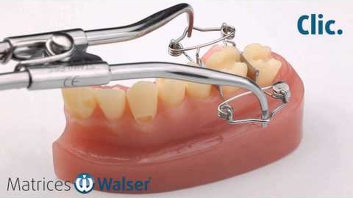 Clip vidéo : matrice dentaire Walser forme en O en application