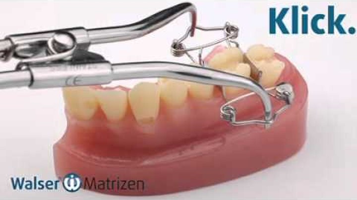 Videoclip: Walser Zahn-Matrize O-Form im Einsatz