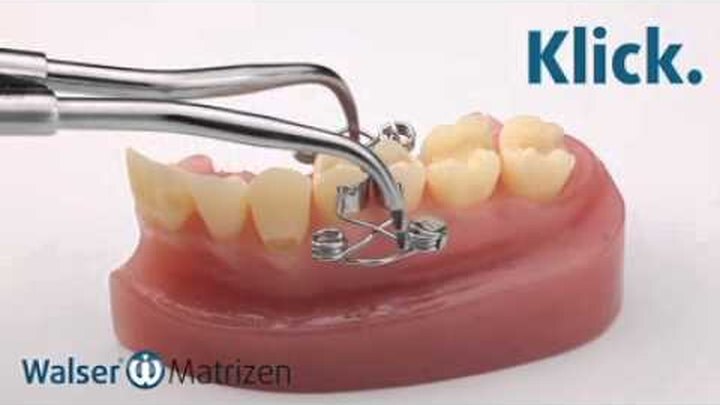 Videoclip: Walser Zahn-Matrize X-Form im Einsatz