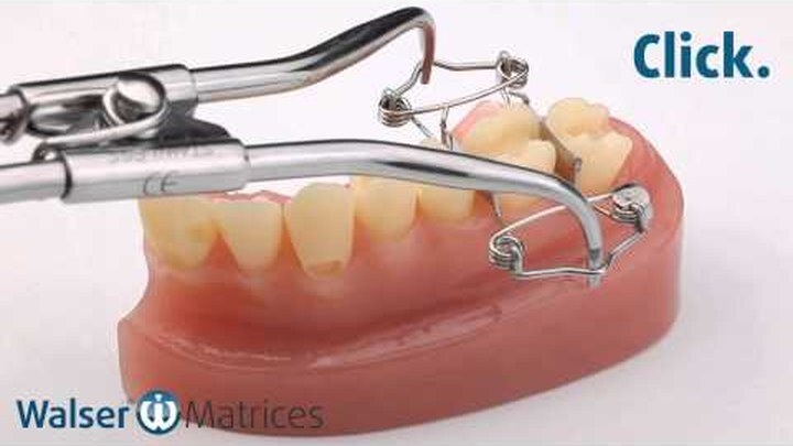 Video clip: Walser dental matrix O-shape in use